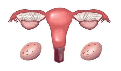 女性月经提前是卵巢早衰的症状？可能是这3种疾病在提醒你