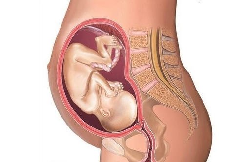 子宫腺肌症会影响怀孕吗？