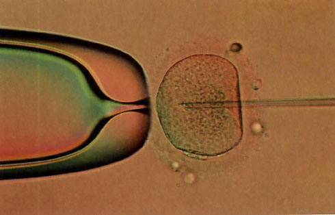 囊胚会在24小时内植入吗？