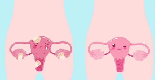 唐山供卵试管成功率：没有输卵管会影响试管婴儿的成功率吗？