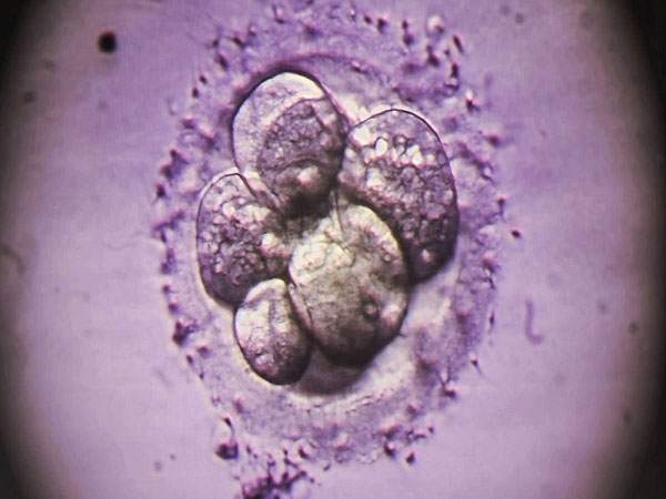 天津助孕龙凤胎哪家好：4bc囊胚的成功移植：第二天是做得好的最关键一天
